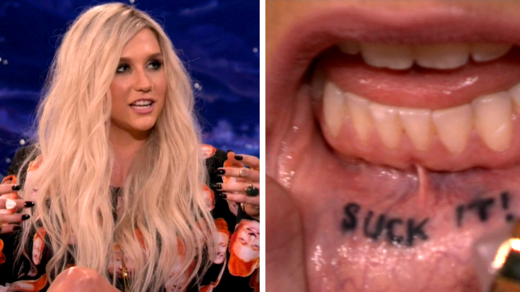 Kesha