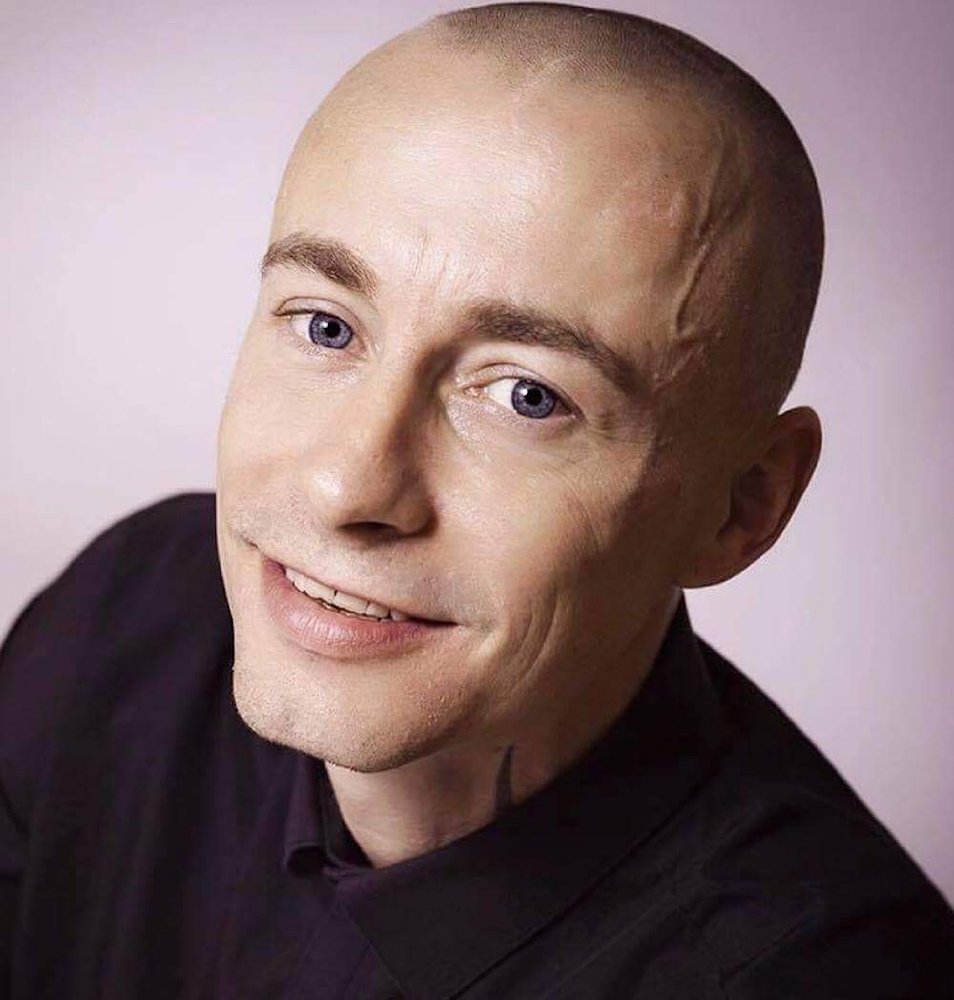 Damian Verguson